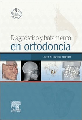 DIAGNÓSTICO Y TRATAMIENTO EN ORTODONCIA + STUDENTCONSULT EN ESPAÑOL de Josep Maria Ustrell Torrent